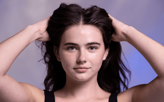 Understanding the Different Types of Acne in the Treatment Room