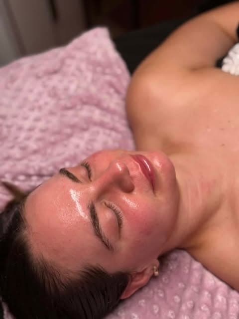 Glo2Facial treatment post