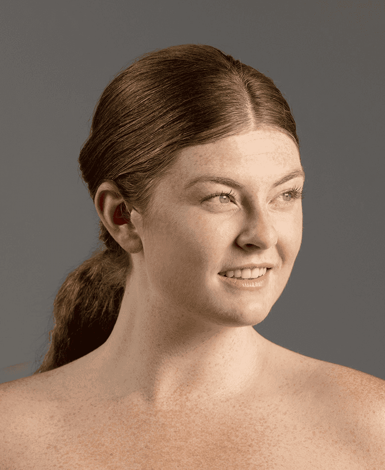 Fine Lines & Wrinkles Glo2Facial skin concern