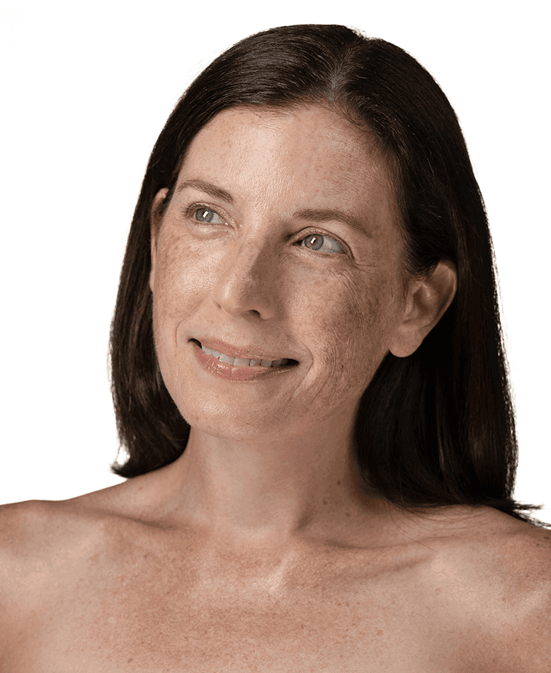 Dryness & Dullness Glo2Facial skin concern