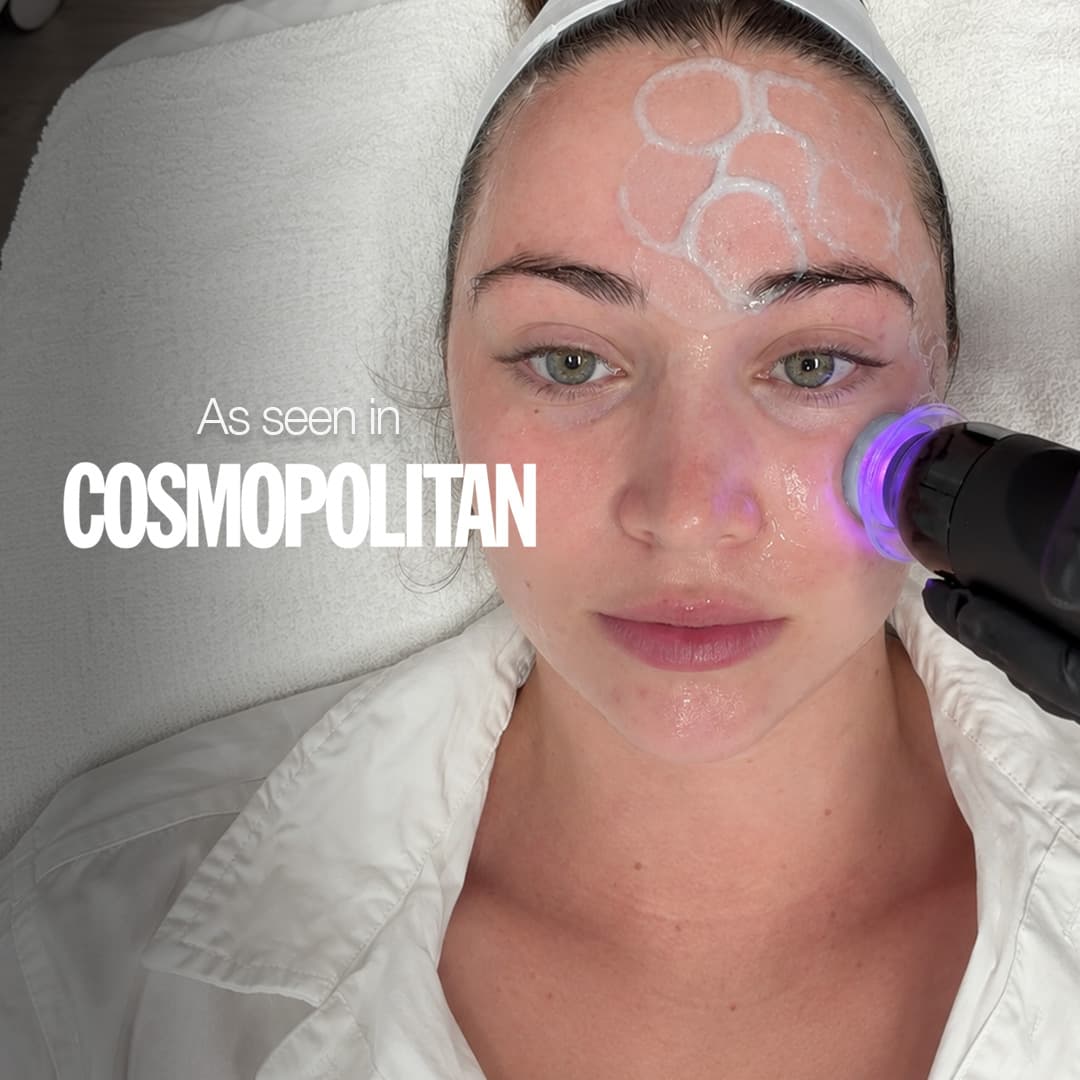 Glo2Facial as seen in Cosmopolitan