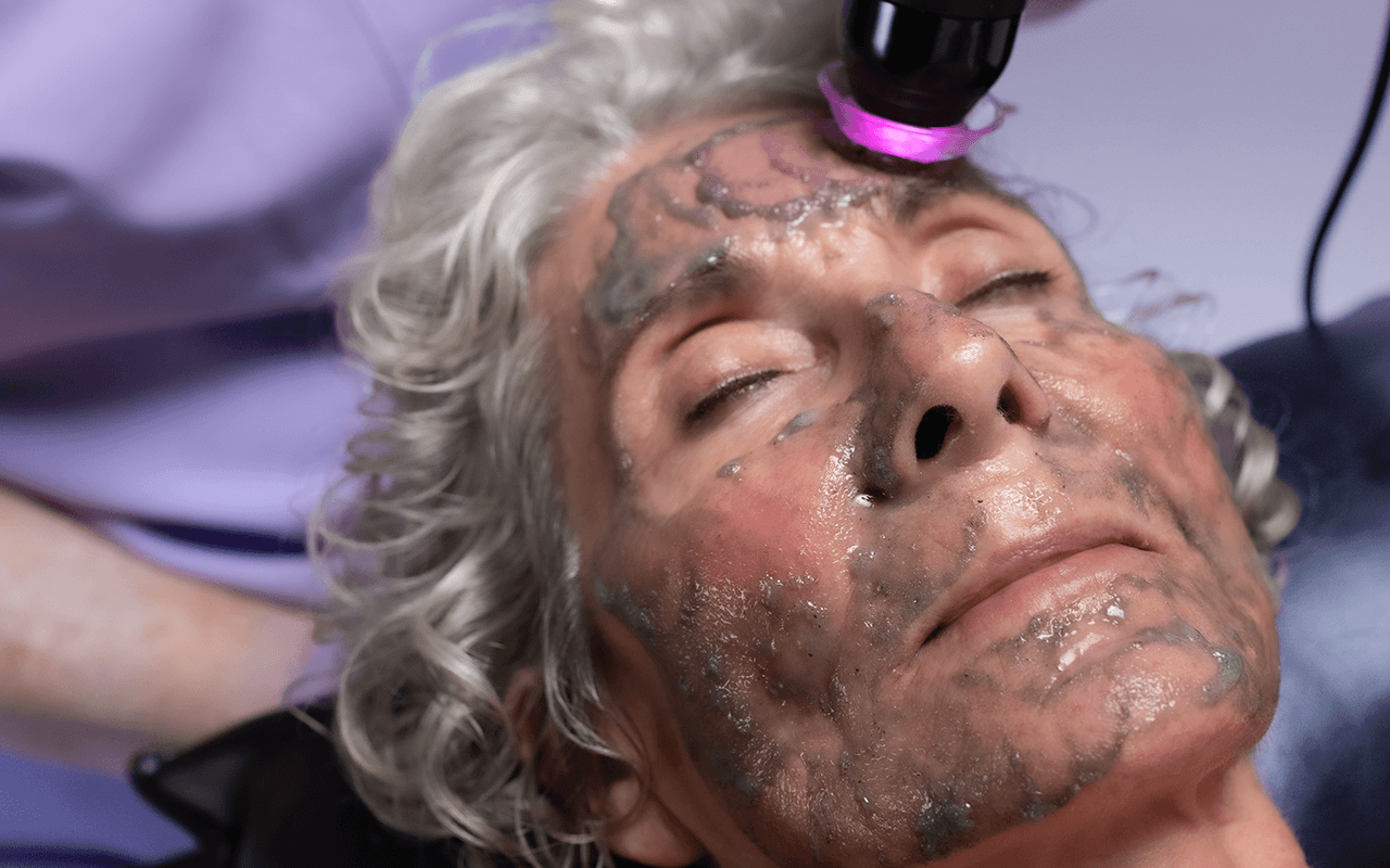 best treatment for rough skin texture